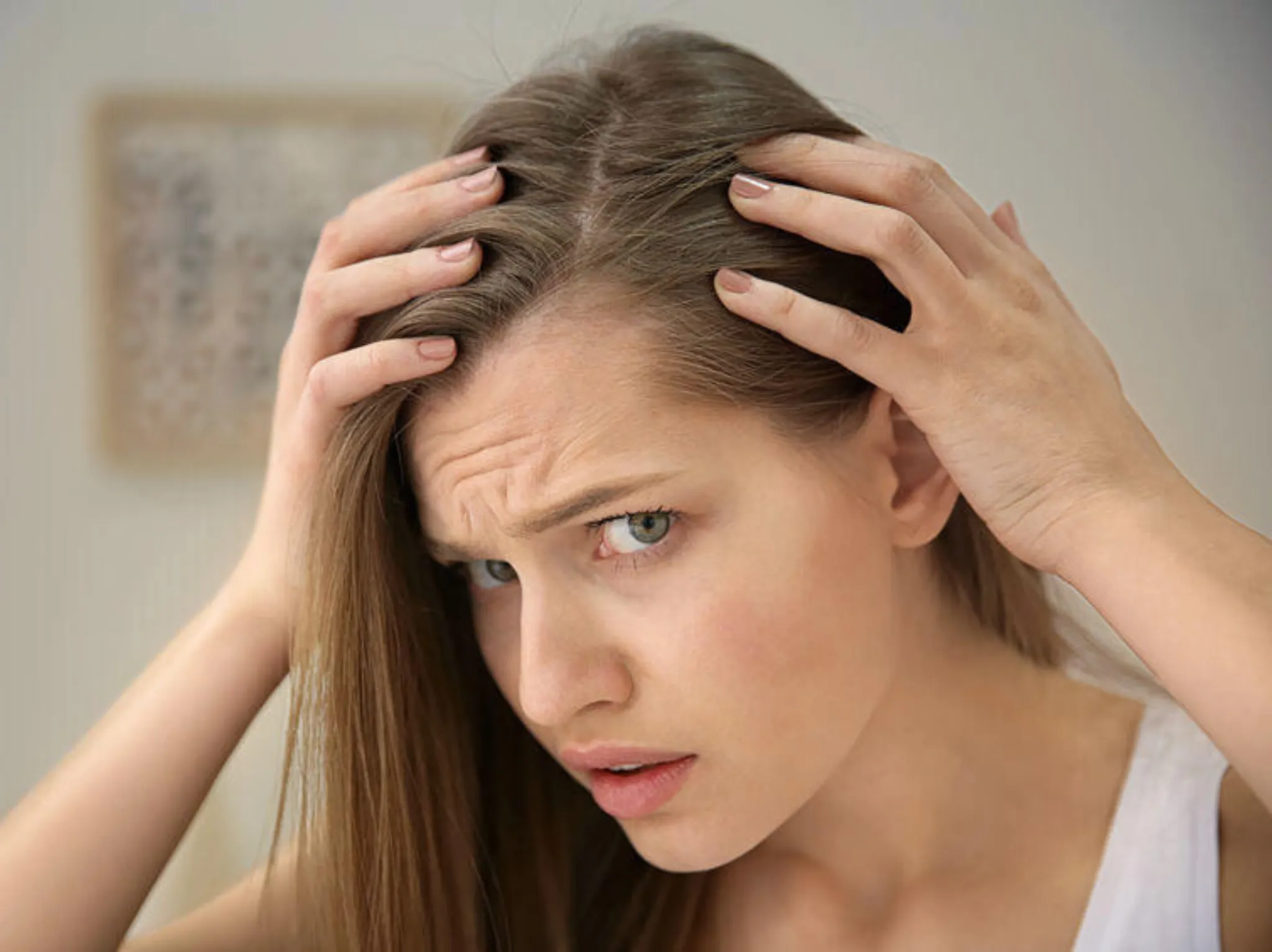 Dandruff treatment in Istanbul: Causes and Treatment methods 2025