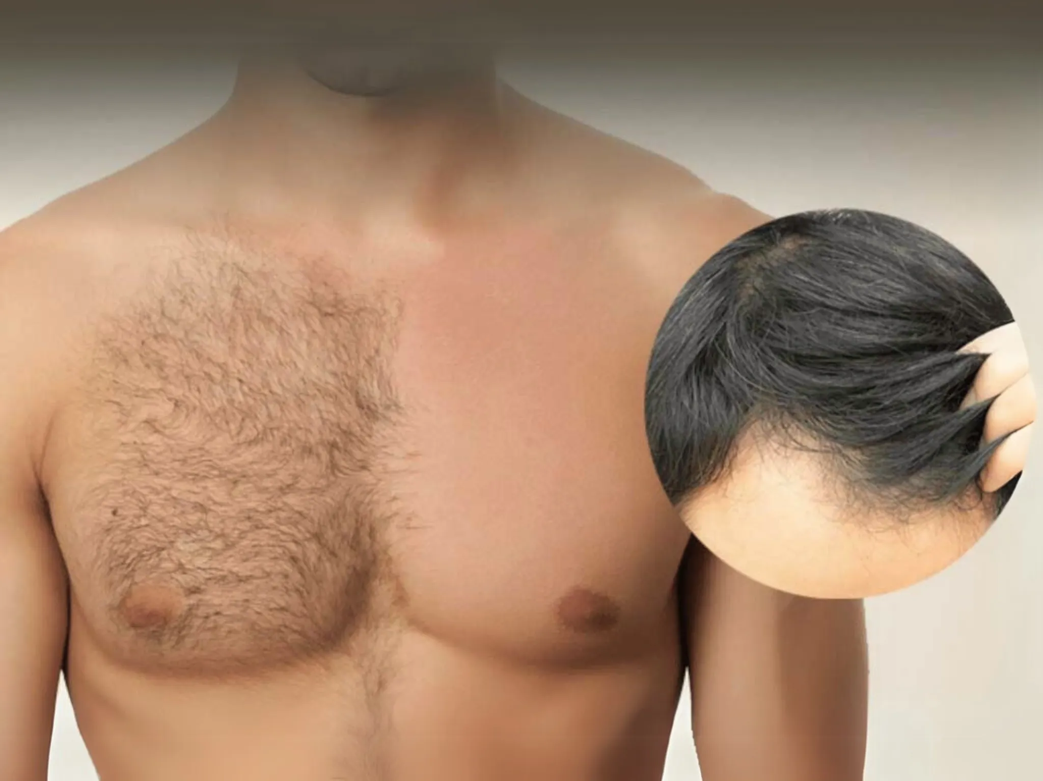زراعة الشعر باستخدام شعر الجسم في إسطنبول ونتائجها 2025