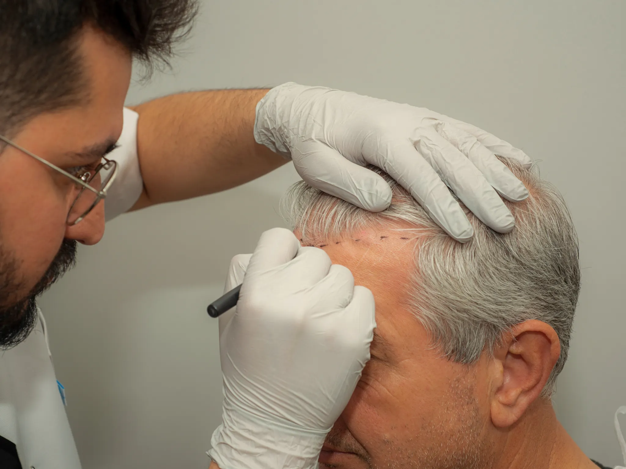 كيف تؤثر الاختلافات العرقية على زراعة الشعر؟